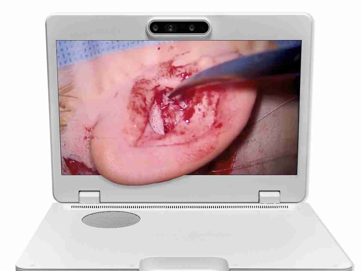 达擎之＂Heads-up 3D显微手术显示系统＂，，整合4K裸眼3D显示及眼球追踪系统，，具备快速追踪人眼移动位置功能，，，，减轻医师长时间维持固定姿势的负担，，，让医师能有更宽广清晰的3D立体视野及更舒适的姿势来执行手术。。